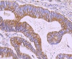 Invitrogen ERP29 Recombinant Rabbit Monoclonal Antibody (JG34-42) 100 &mu;L;