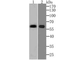 Invitrogen PARP2 Recombinant Rabbit Monoclonal Antibody (JG34-56) 100 &mu;L;