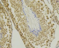 Invitrogen CHD1L Recombinant Rabbit Monoclonal Antibody (JG35-44) 100 &mu;L;