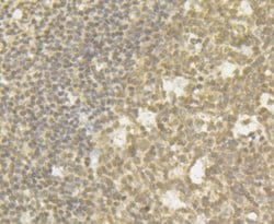 Invitrogen CHD1L Recombinant Rabbit Monoclonal Antibody (JG35-44) 100 &mu;L;