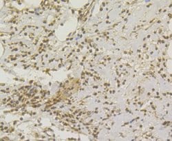 Invitrogen CHD1L Recombinant Rabbit Monoclonal Antibody (JG35-44) 100 &mu;L;
