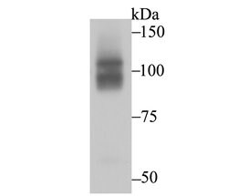 Invitrogen CHD1L Recombinant Rabbit Monoclonal Antibody (JG35-44) 100 &mu;L;