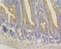 Invitrogen Syntrophin alpha-1 Recombinant Rabbit Monoclonal Antibody (JG35-62)