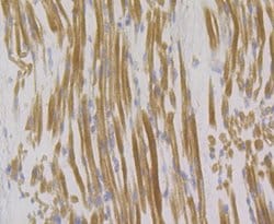Invitrogen Syntrophin alpha-1 Recombinant Rabbit Monoclonal Antibody (JG35-62)