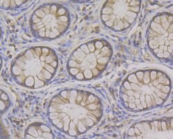 Invitrogen Syntrophin alpha-1 Recombinant Rabbit Monoclonal Antibody (JG35-62)