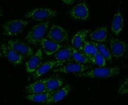 Invitrogen TREX1 Recombinant Rabbit Monoclonal Antibody (JG35-71) 100 &mu;L;