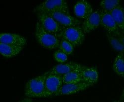 Invitrogen TREX1 Recombinant Rabbit Monoclonal Antibody (JG35-71) 100 &mu;L;