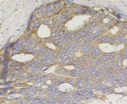 Invitrogen TREX1 Recombinant Rabbit Monoclonal Antibody (JG35-71) 100 &mu;L;