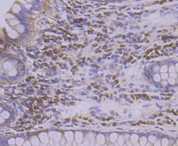 Invitrogen TREX1 Recombinant Rabbit Monoclonal Antibody (JG35-71) 100 &mu;L;