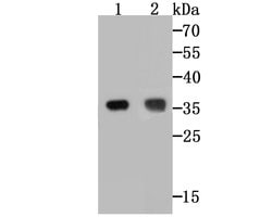 Invitrogen TREX1 Recombinant Rabbit Monoclonal Antibody (JG35-71) 100 &mu;L;