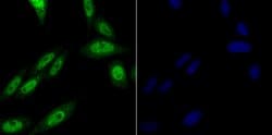 Invitrogen PRP8 Recombinant Rabbit Monoclonal Antibody (JG57-38) 100 &mu;L;