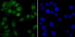Invitrogen PRP8 Recombinant Rabbit Monoclonal Antibody (JG57-38) 100 &mu;L;