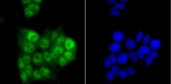 Invitrogen PRP8 Recombinant Rabbit Monoclonal Antibody (JG57-38) 100 &mu;L;