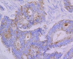 Invitrogen FBXO5 Recombinant Rabbit Monoclonal Antibody (JG35-83) 100 &mu;L;