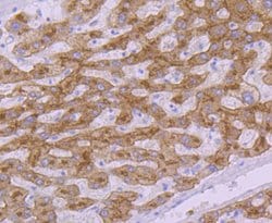 Invitrogen&trade;&nbsp;TFR2 Recombinant Rabbit Monoclonal Antibody (JG58-34)