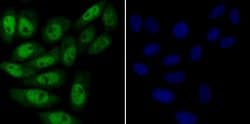 Invitrogen MYST1 Recombinant Rabbit Monoclonal Antibody (JG36-05) 100 &mu;L;