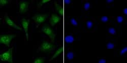 Invitrogen MYST1 Recombinant Rabbit Monoclonal Antibody (JG36-05) 100 &mu;L;