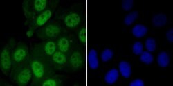 Invitrogen MYST1 Recombinant Rabbit Monoclonal Antibody (JG36-05) 100 &mu;L;