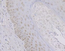 Invitrogen MYST1 Recombinant Rabbit Monoclonal Antibody (JG36-05) 100 &mu;L;