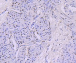 Invitrogen MYST1 Recombinant Rabbit Monoclonal Antibody (JG36-05) 100 &mu;L;