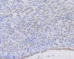 Invitrogen MYST1 Recombinant Rabbit Monoclonal Antibody (JG36-05) 100 &mu;L;