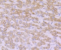 Invitrogen NDUFB8 Recombinant Rabbit Monoclonal Antibody (JG61-36) 100 &mu;L | Buy Online | Invitrogen&trade; | Fisher Scientific