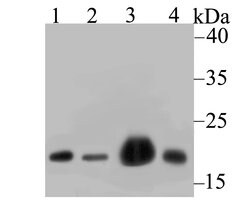Invitrogen NDUFB8 Recombinant Rabbit Monoclonal Antibody (JG61-36) 100 &mu;L | Buy Online | Invitrogen&trade; | Fisher Scientific