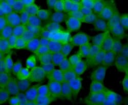Invitrogen SULT2A1 Recombinant Rabbit Monoclonal Antibody (JG36-18) 100
