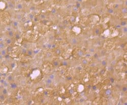 Invitrogen SULT2A1 Recombinant Rabbit Monoclonal Antibody (JG36-18) 100