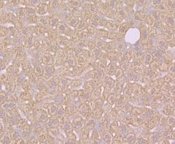 Invitrogen SULT2A1 Recombinant Rabbit Monoclonal Antibody (JG36-18) 100