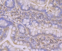 Invitrogen SULT2A1 Recombinant Rabbit Monoclonal Antibody (JG36-18) 100
