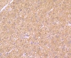 Invitrogen SULT2A1 Recombinant Rabbit Monoclonal Antibody (JG36-18) 100
