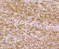 Invitrogen SULT2A1 Recombinant Rabbit Monoclonal Antibody (JG36-18) 100