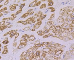 Invitrogen FHL2 Recombinant Rabbit Monoclonal Antibody (JG36-42) 100 &mu;L;