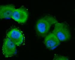 Invitrogen p53DINP1 Recombinant Rabbit Monoclonal Antibody (JG37-64) 100