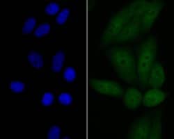 Invitrogen p53DINP1 Recombinant Rabbit Monoclonal Antibody (JG37-64) 100