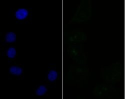 Invitrogen SF3B3 Recombinant Rabbit Monoclonal Antibody (JG63-53) 100 &mu;L;