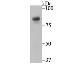 Invitrogen Nicastrin Recombinant Rabbit Monoclonal Antibody (JG68-33) 100