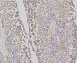 Invitrogen WNK1 Recombinant Rabbit Monoclonal Antibody (JG36-91) 100 &mu;L | Buy Online | Invitrogen&trade; | Fisher Scientific