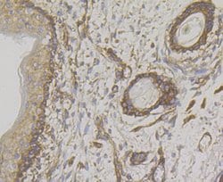 Invitrogen WNK1 Recombinant Rabbit Monoclonal Antibody (JG36-91) 100 &mu;L | Buy Online | Invitrogen&trade; | Fisher Scientific