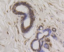 Invitrogen WNK1 Recombinant Rabbit Monoclonal Antibody (JG36-91) 100 &mu;L | Buy Online | Invitrogen&trade; | Fisher Scientific