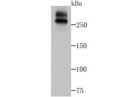 Invitrogen WNK1 Recombinant Rabbit Monoclonal Antibody (JG36-91) 100 &mu;L | Buy Online | Invitrogen&trade; | Fisher Scientific