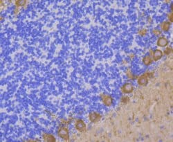 Invitrogen PKC gamma Recombinant Rabbit Monoclonal Antibody (JG69-32) 100 &mu;L | Buy Online | Invitrogen&trade; | Fisher Scientific