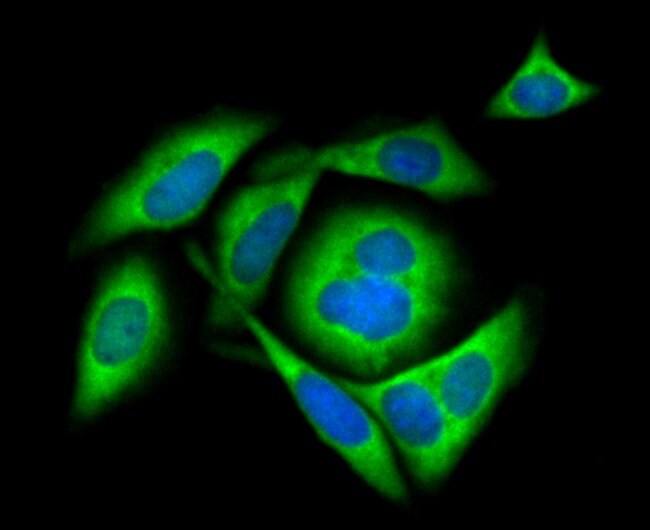 MIB1 Rabbit Monoclonal Antibody (JG6934), Invitrogen 100