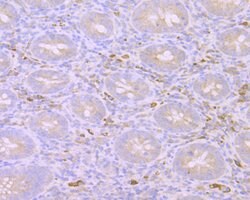 Invitrogen MIB1 Recombinant Rabbit Monoclonal Antibody (JG69-34) 100 &mu;L | Buy Online | Invitrogen&trade; | Fisher Scientific