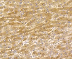 Invitrogen Tetranectin Recombinant Rabbit Monoclonal Antibody (JG37-16) 100 &mu;L | Buy Online | Invitrogen&trade; | Fisher Scientific