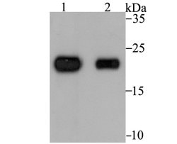 Invitrogen Tetranectin Recombinant Rabbit Monoclonal Antibody (JG37-16) 100 &mu;L | Buy Online | Invitrogen&trade; | Fisher Scientific