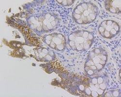 Invitrogen Fibrinogen gamma Recombinant Rabbit Monoclonal Antibody (JG37-18)