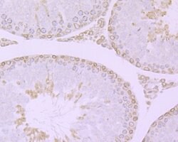 Invitrogen RANGAP1 Recombinant Rabbit Monoclonal Antibody (JG37-41) 100