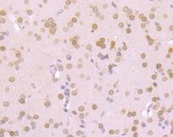 Invitrogen RANGAP1 Recombinant Rabbit Monoclonal Antibody (JG37-41) 100